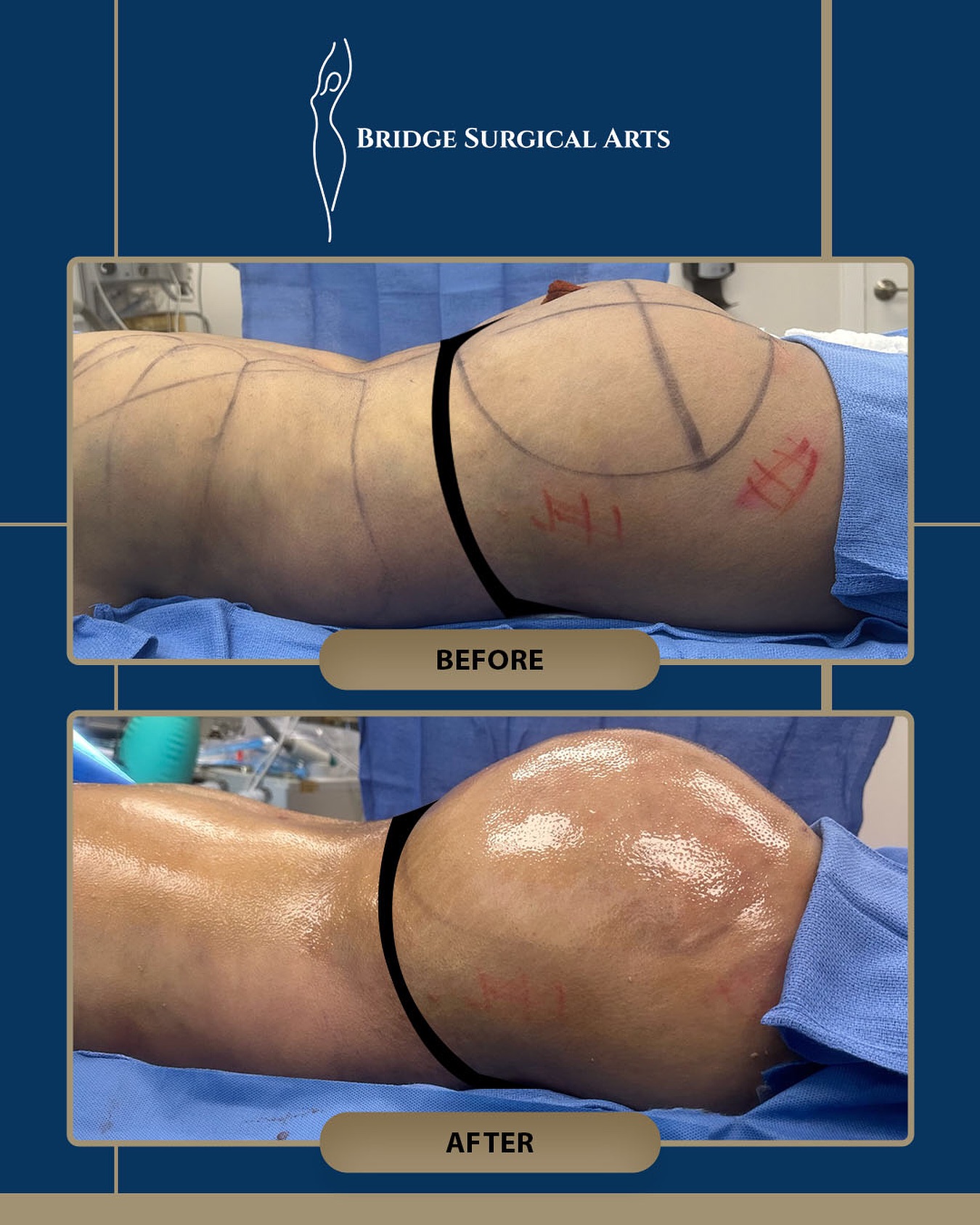 Before and after result 1