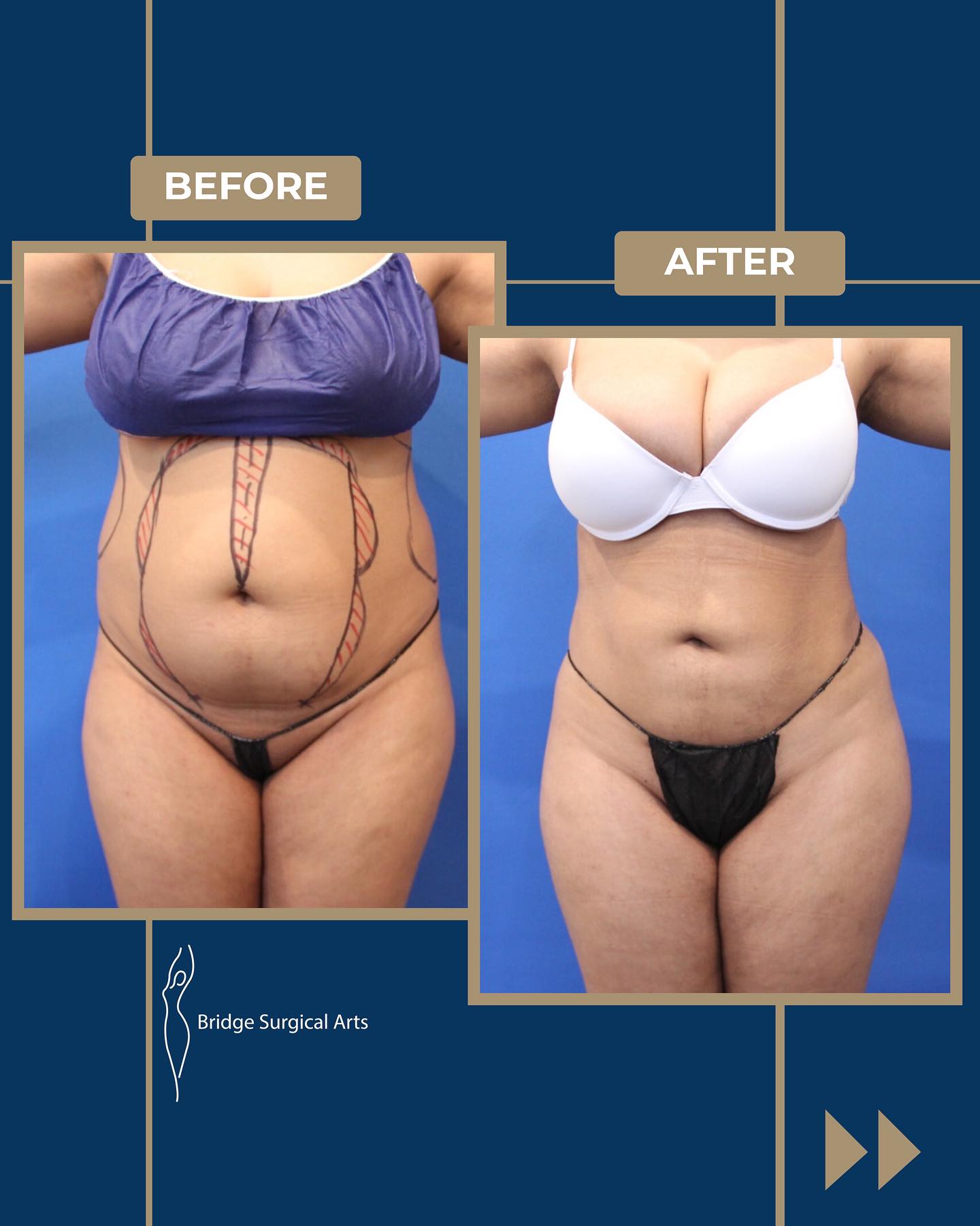 Before and after result 2