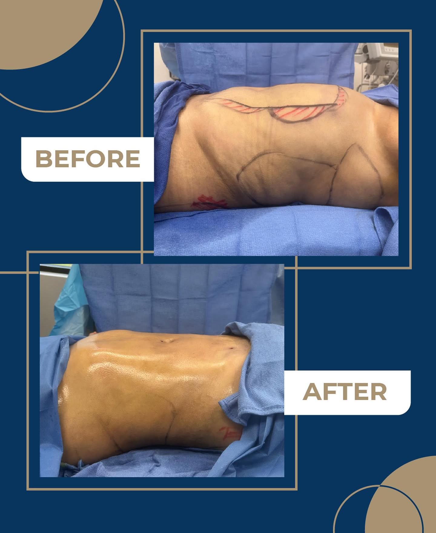 Before and after result 4